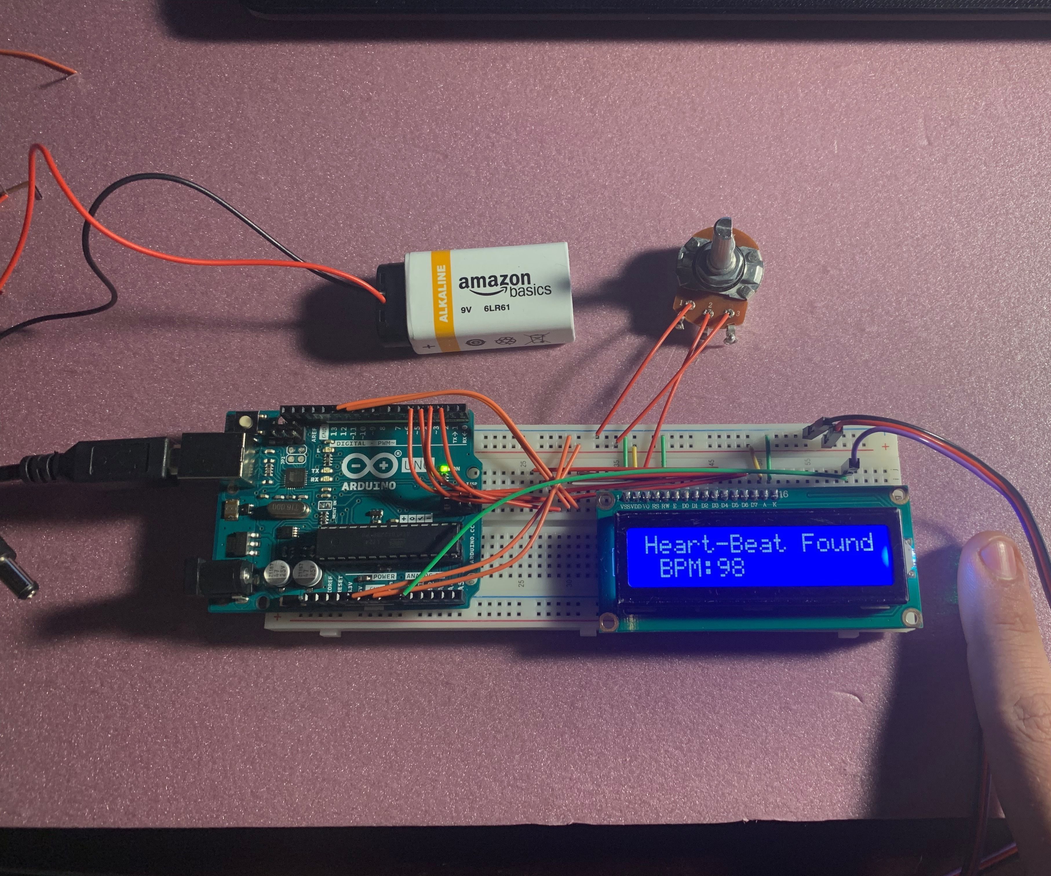 Rate Based Arrhythmia Detector Using Arduino