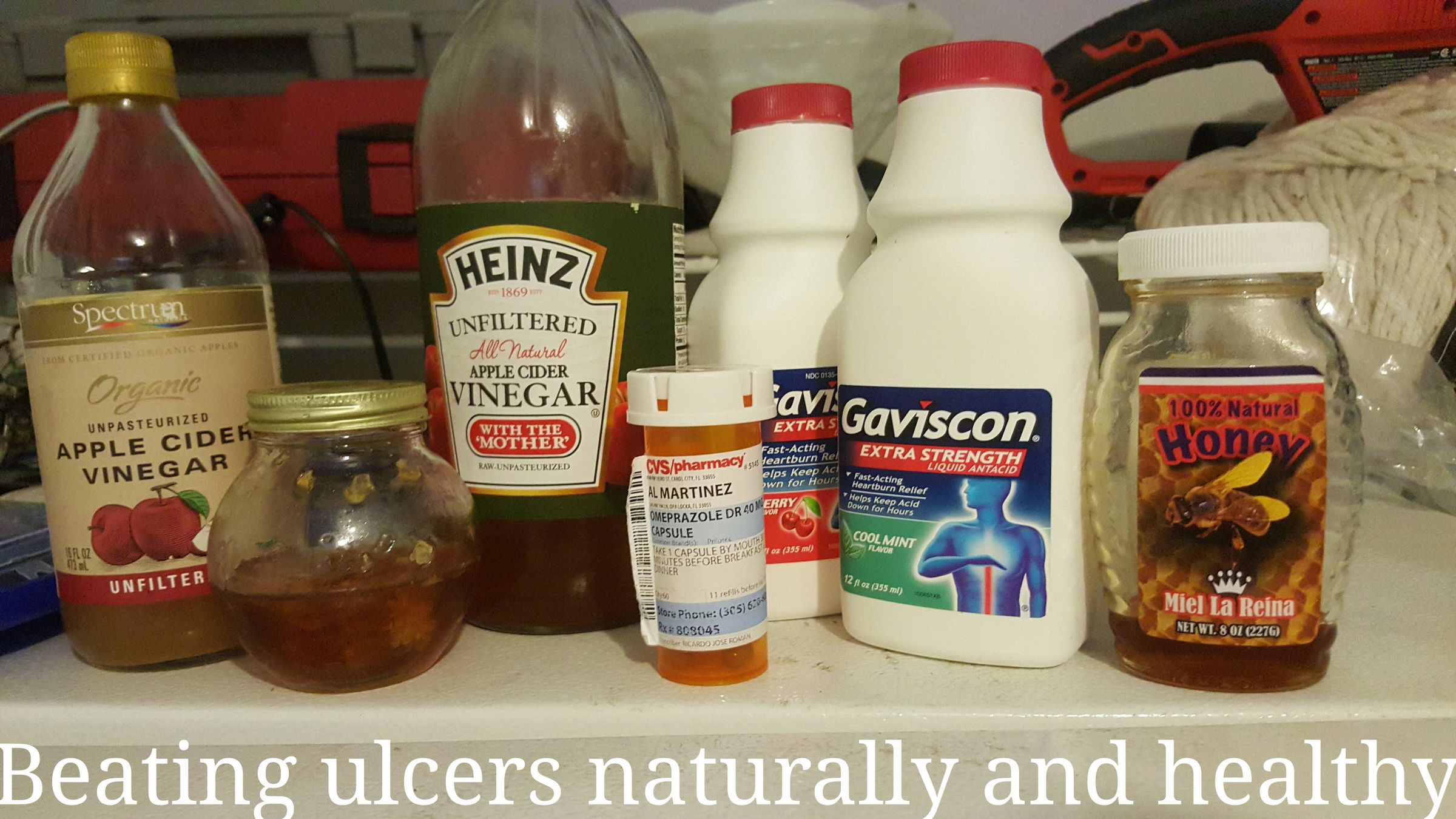 Let's Beat Stomach or Instetinals Ulcers.  Naturally 