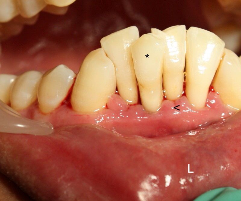 Grasping the Backdrop of Dental Implants Houston.