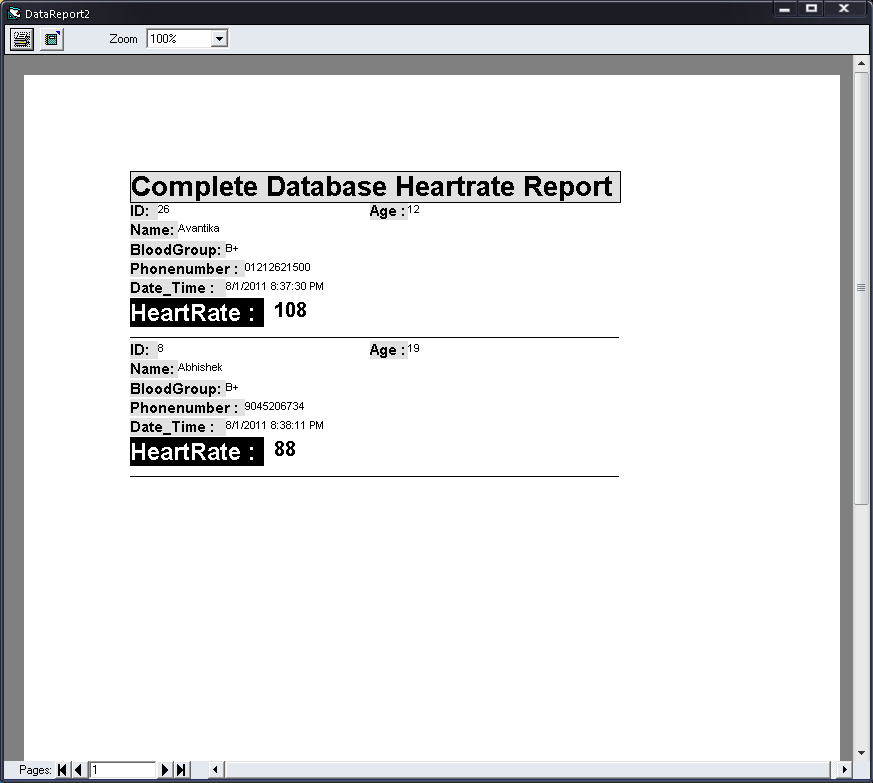 Heart Rate Monitor With PC Connectivity : 4 Steps - Instructables