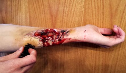 *Bonus: Final Bruise Effects