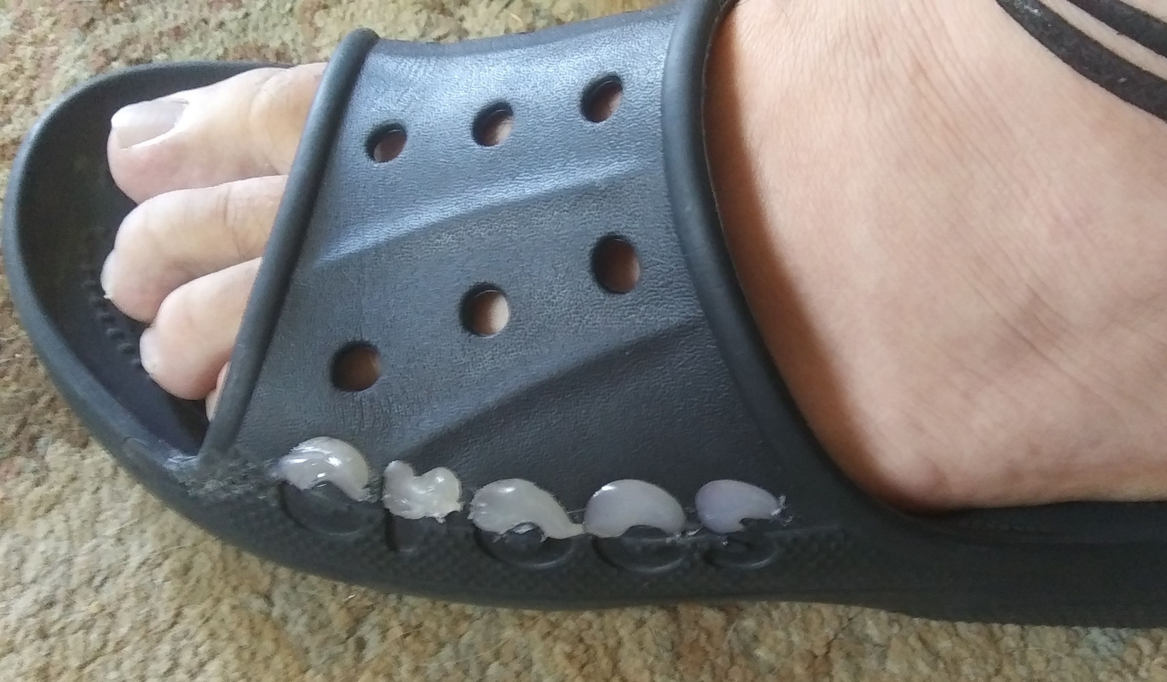 Crocs the 'Rip Repair' Remix Instructables