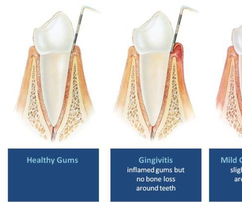 Locate a Greatest Emergency Dentist in Houston
