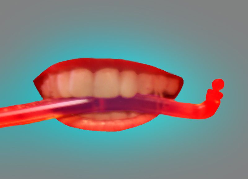 Invisalign Removal Tool - a DIY Fingernail Substitute