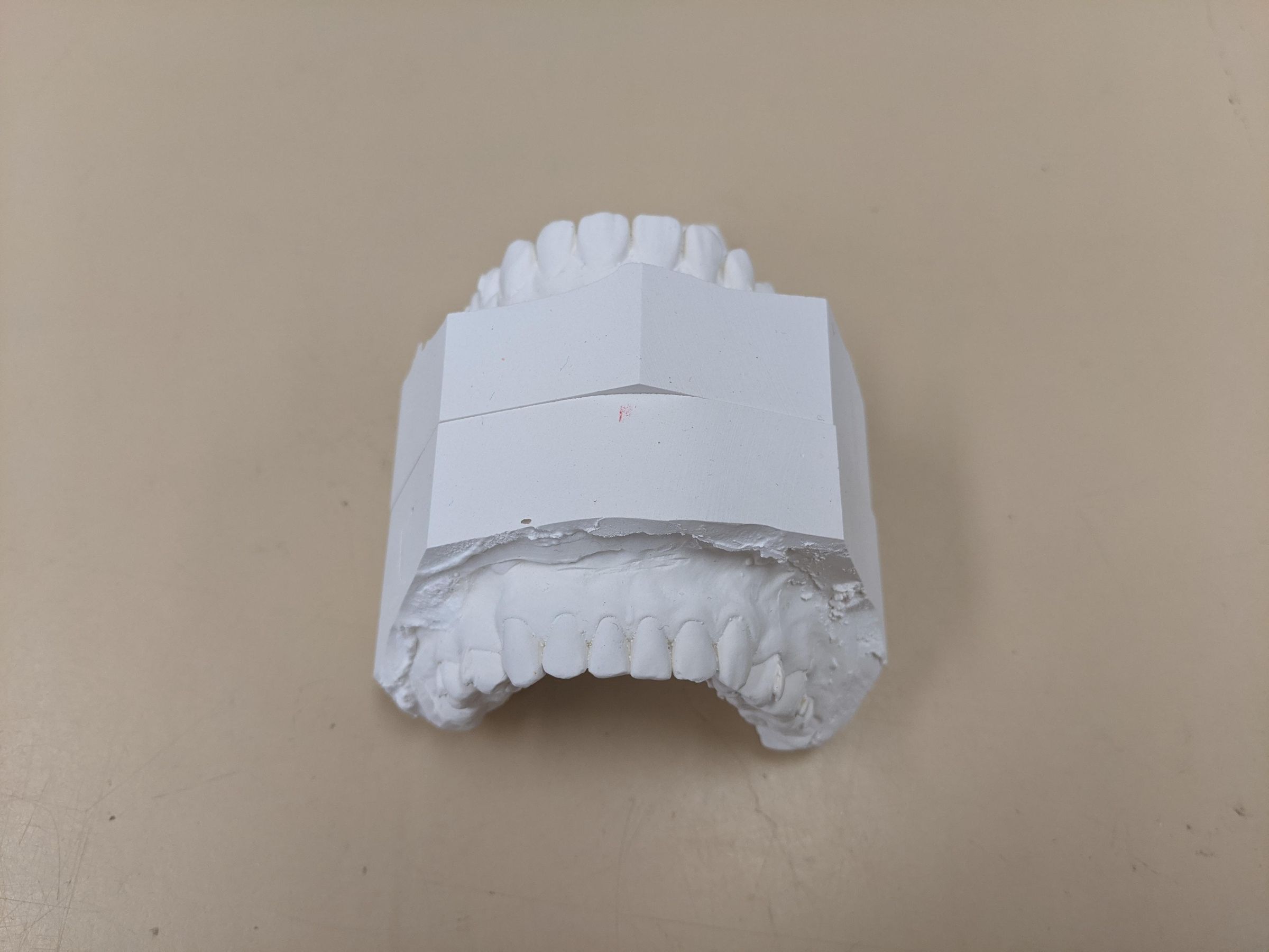A New Method for Trimming Orthodontic Study Model 8 Steps Instructables