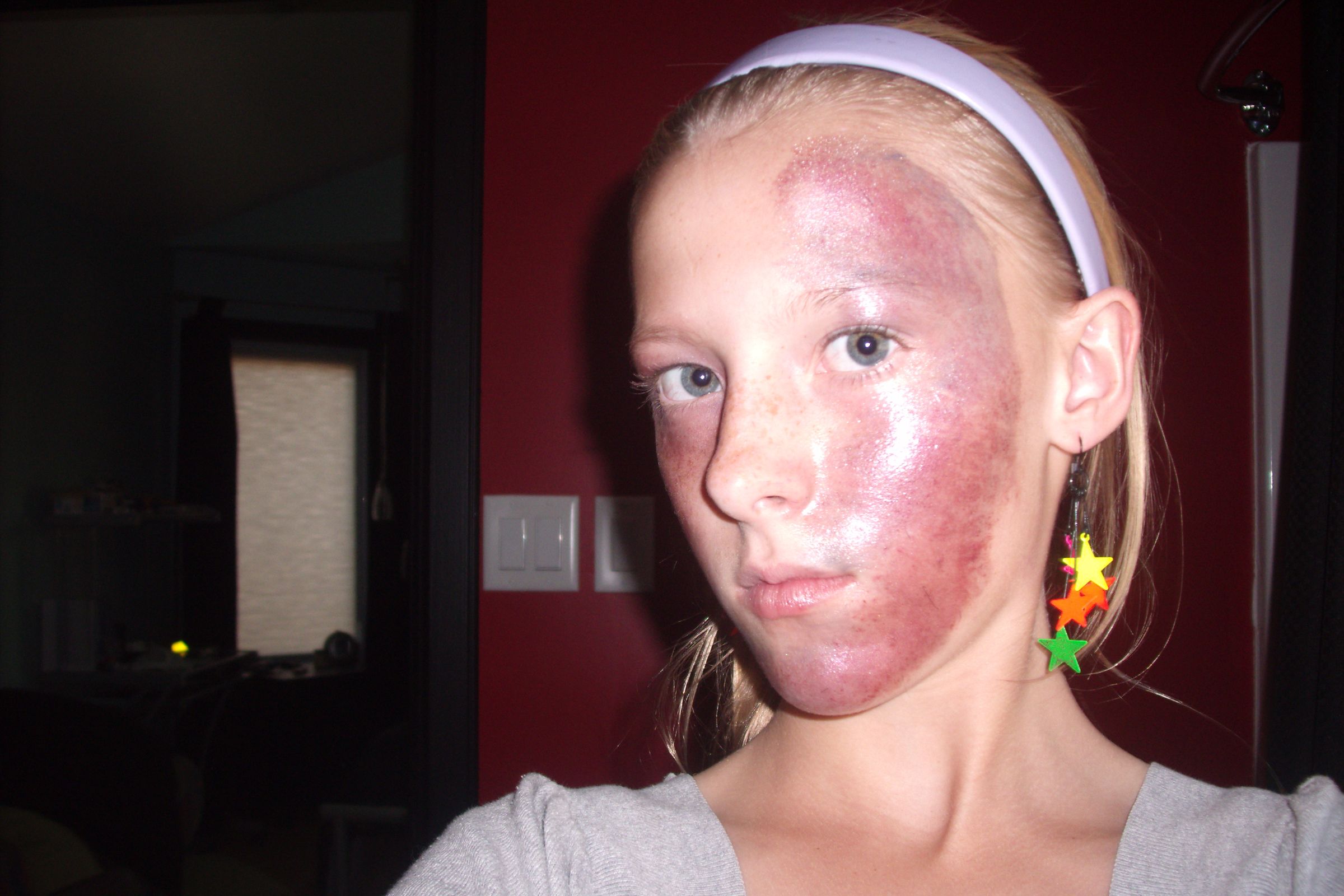 Car Accident Make-up