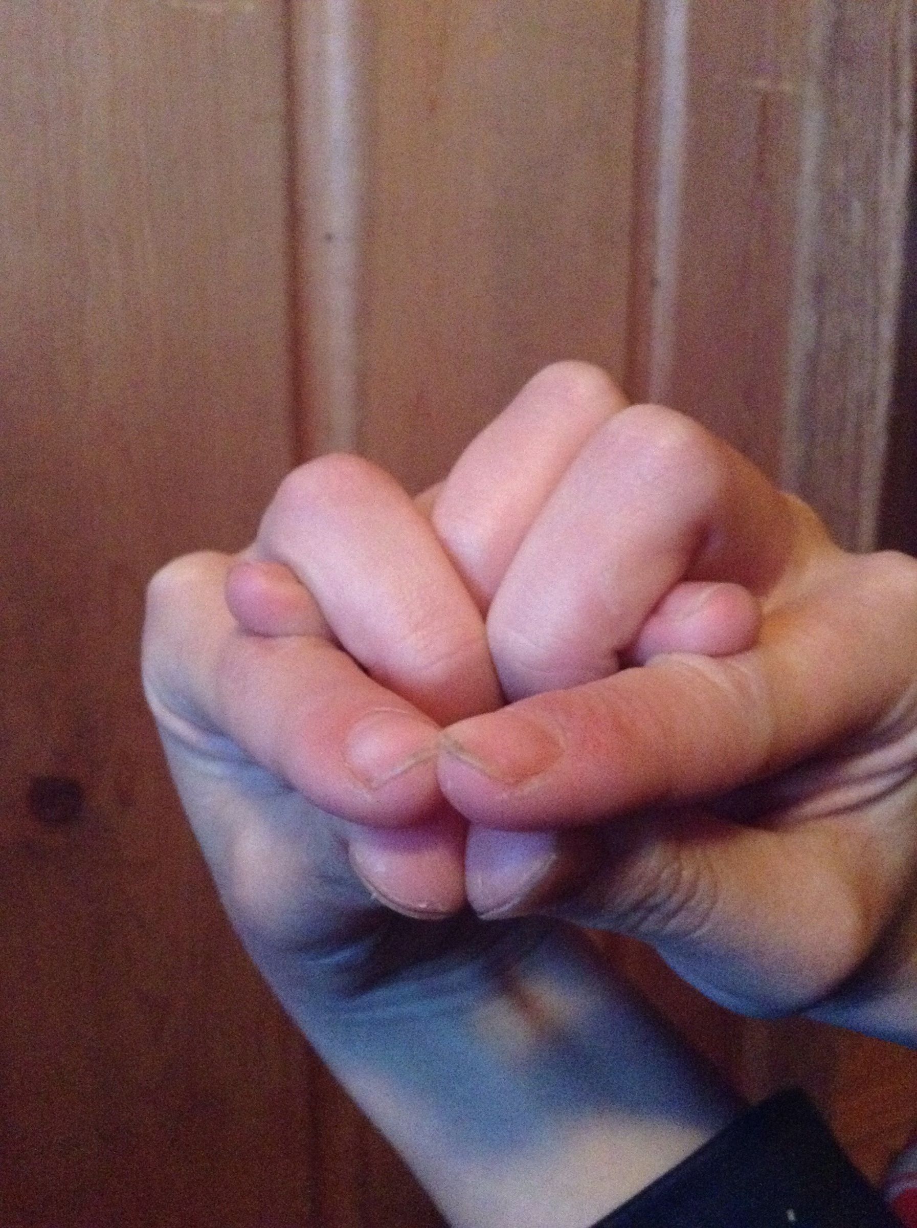 Snake Hands!