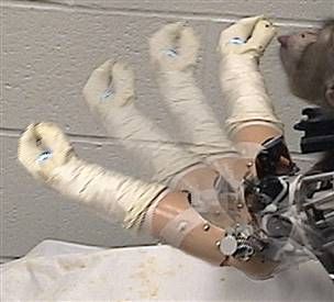 Physiotherapist Robotic Arm..