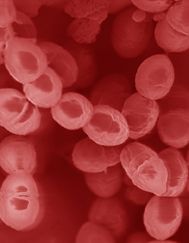 Cultivating Streptococcus Lactis for Multi-Uses.