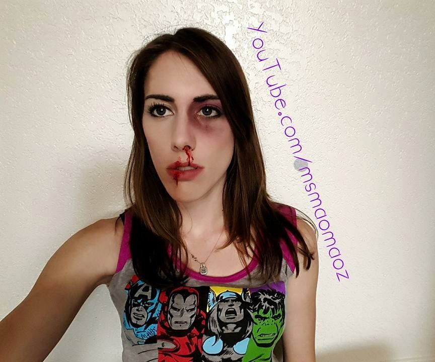 Black Eyes and Cut Lips!