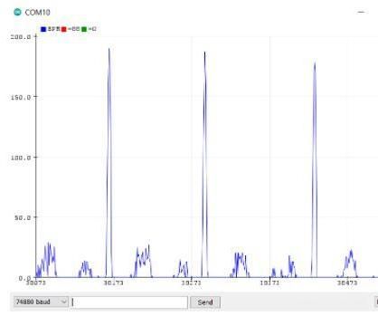 ECG Project- Extra Credit BME 305 Final Design Project