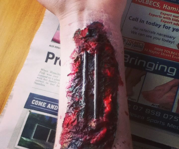 Zombie Wound