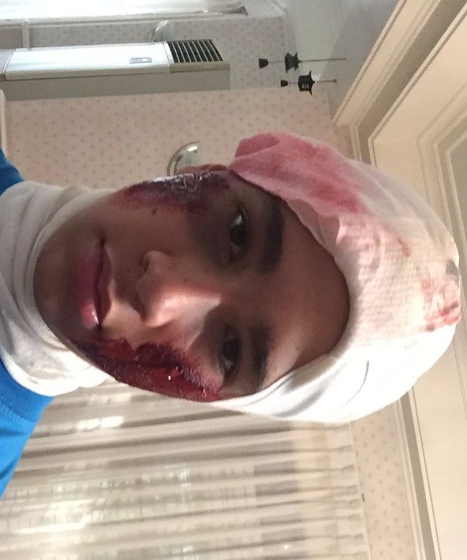 Fake Blood