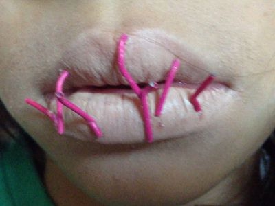 Sharp Teeth - Instructables