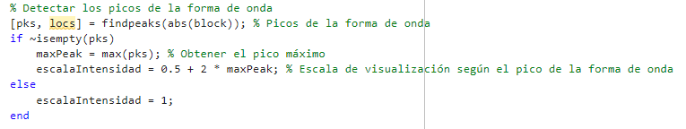 Peak Detection