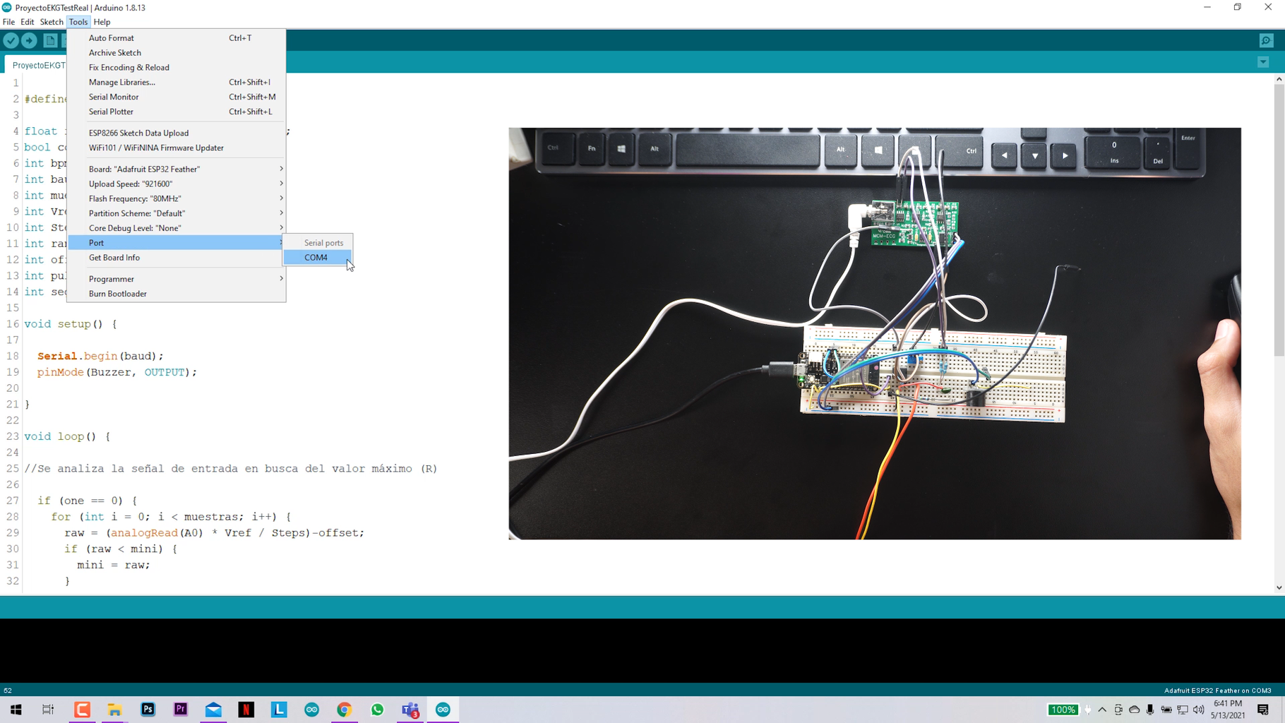 DIY ECG Heart Monitor | Analog Interface + Arduino : 8 Steps ...
