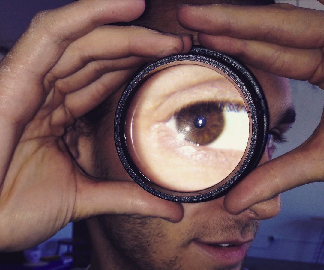 Smartphone Fundus Camera 8 Steps (with Pictures) Instructables