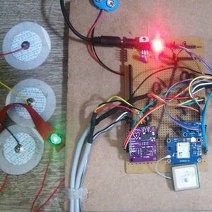 Arduino Based ECG & Heartbeat Monitoring Healthcare System : 8 Steps ...