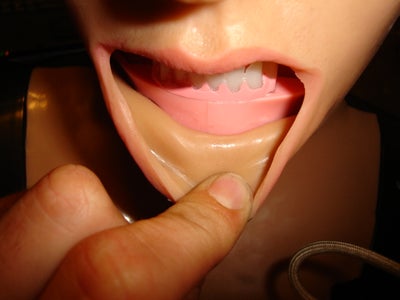 Finnishing the Skin Removal