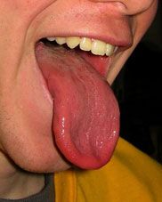 My What and Ugly Mouth You Have!