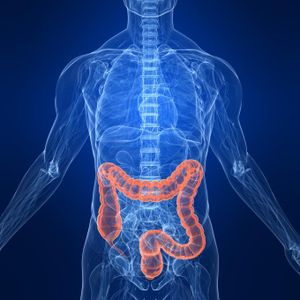 Flowchart for Virtual Colonoscopy Prep