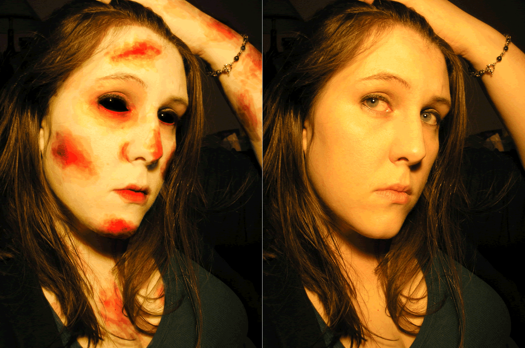 Early Zombie Stage Photo Edit