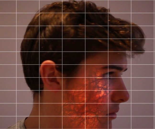 Sub Skin Surface