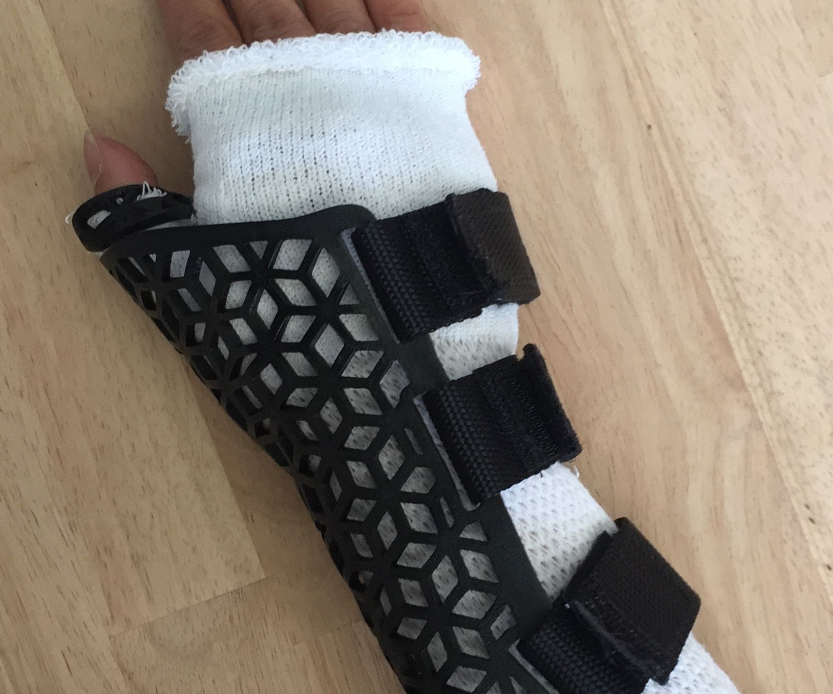 3D Printed - Thumb + Wrist Immobilization Brace 