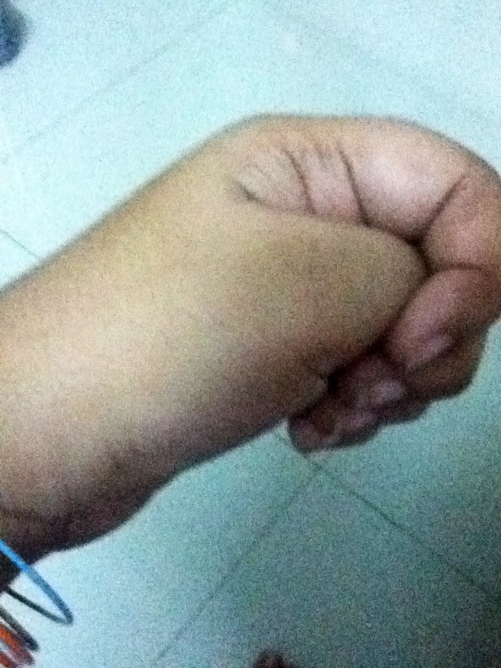 Homemade Makeup Remover *very Very Cheap and Easy*