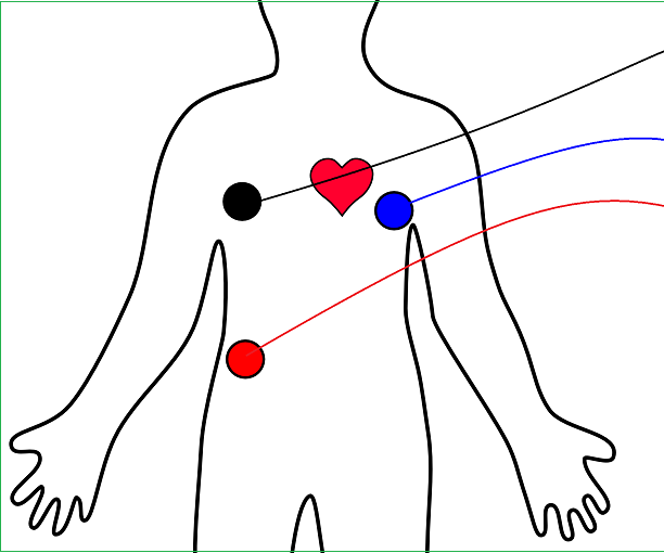 Heart Rate Monitor AD8232 Interface Arduino