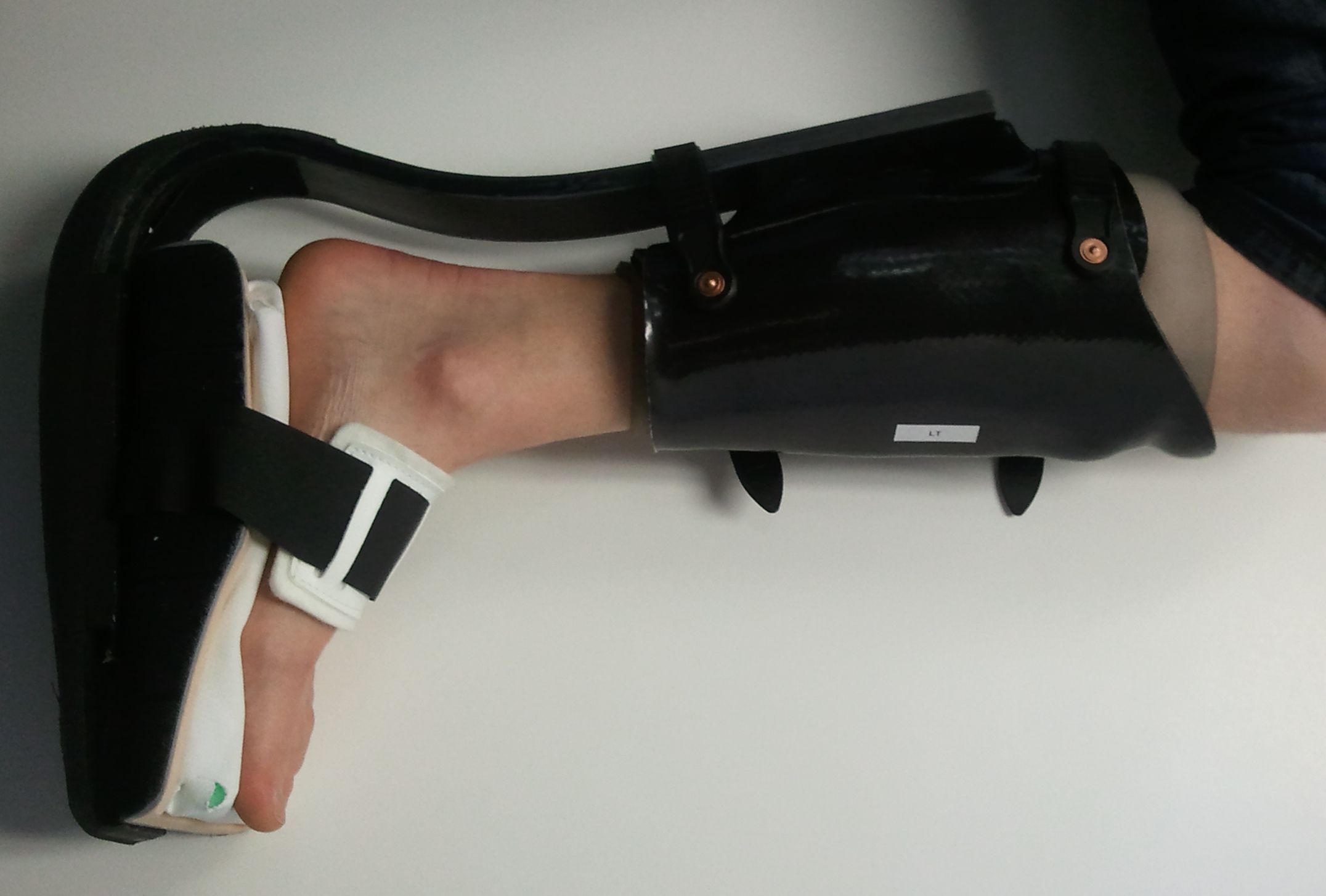 Improve the Toad Anti-Gravity Foot Brace ("TAG" brace)