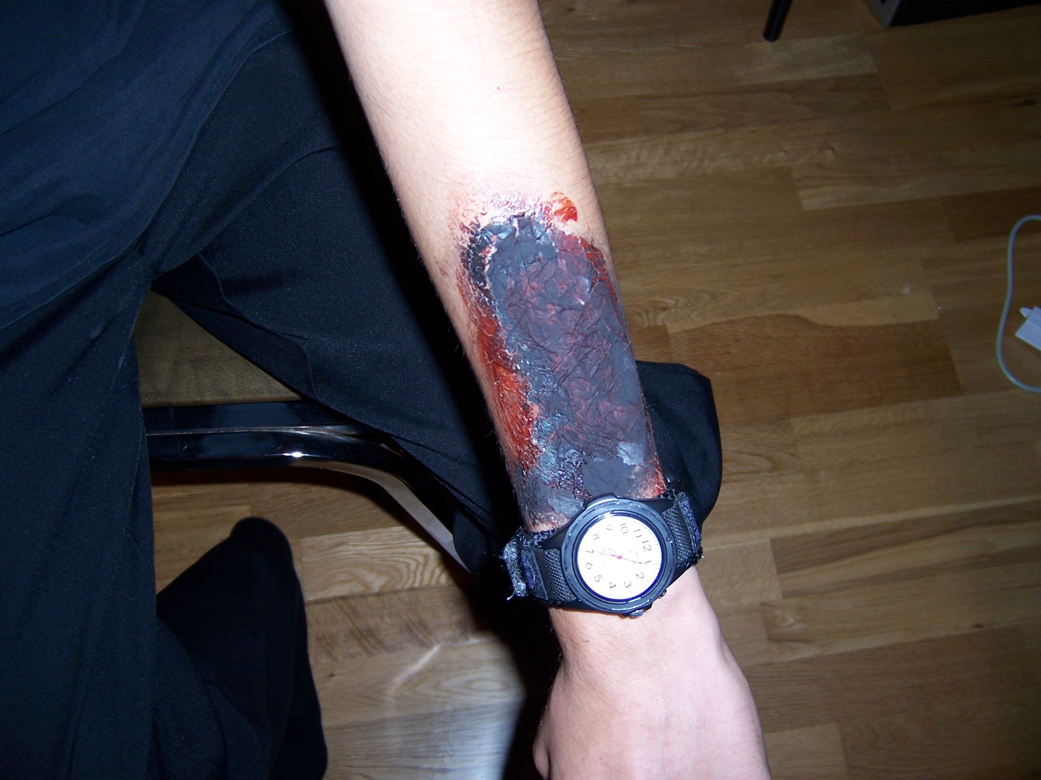 3rd Degree Burn Makeup