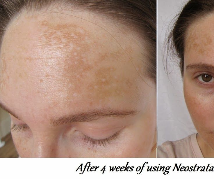 Neostrata Serum
