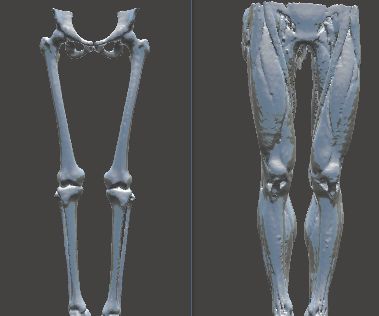 How to Easily and Automatically Convert a CT Scan (DICOM Data) Into a 3D Printable Medical Model (STL File) in Minutes With Free Software and Online Services