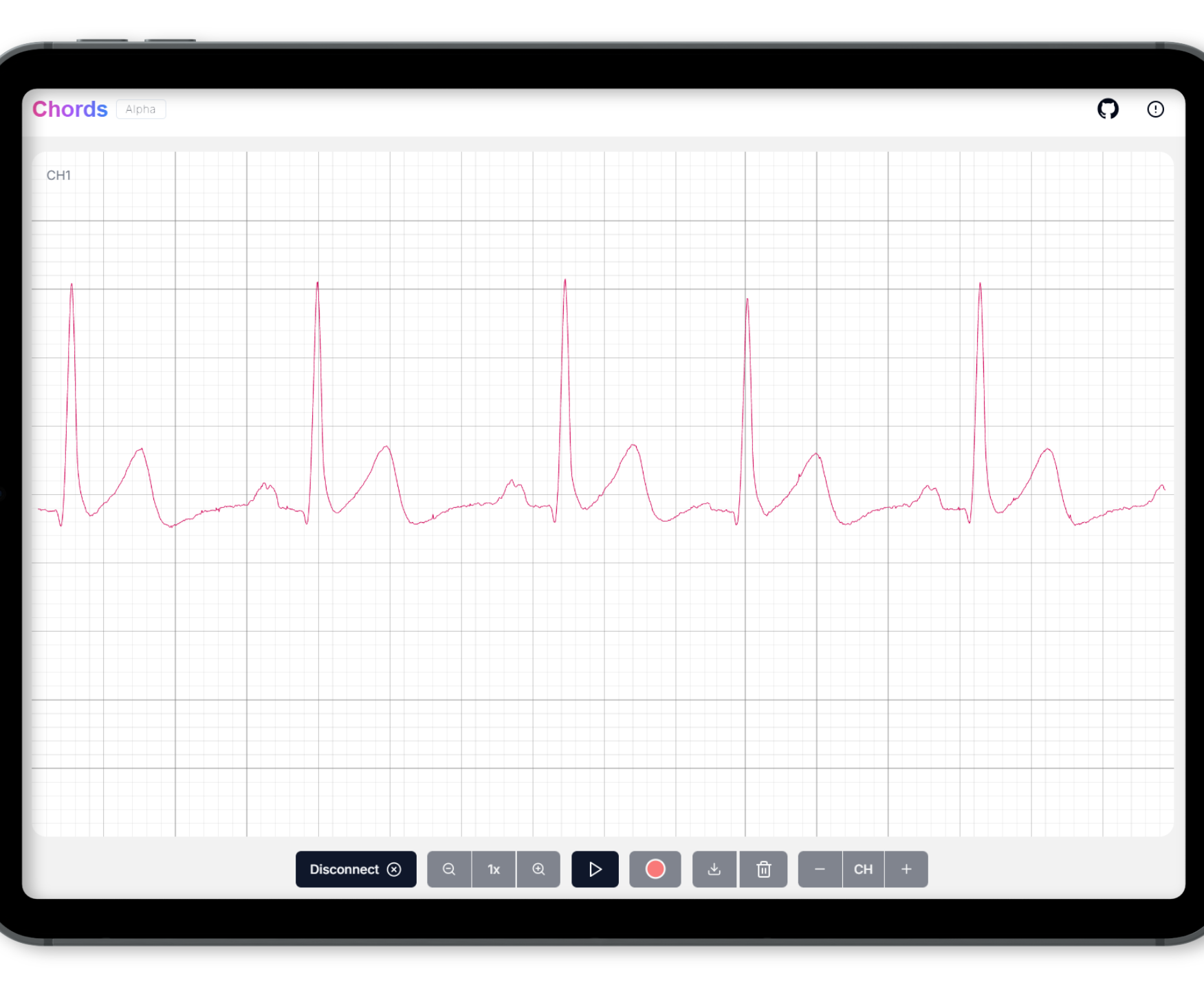 Recording ECG Signals Using Heart BioAmp Candy