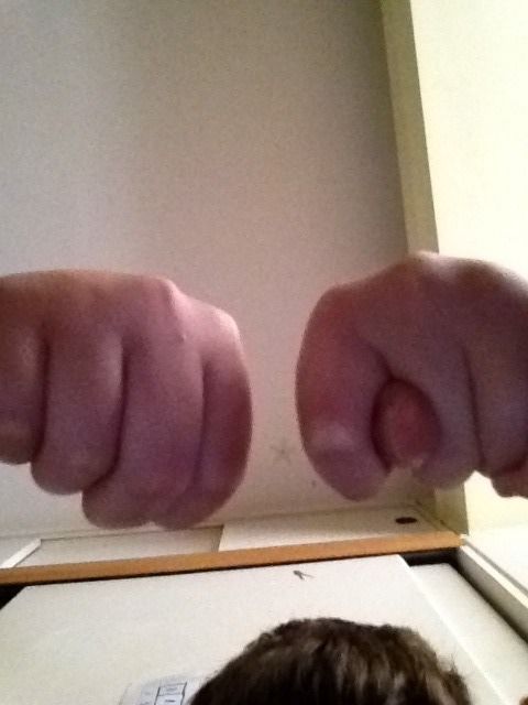Pull Thumb Off Trick!