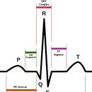 Arduino Portable EKG Monitor