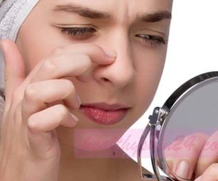 How to Get Rid of Acne Fast