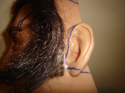 Skin Cutting