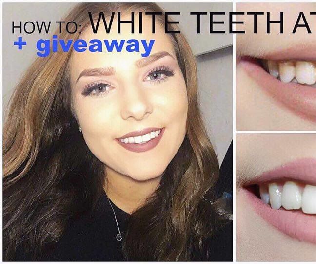 HOW TO GET WHITE TEETH FROM HOME + Giveaway
