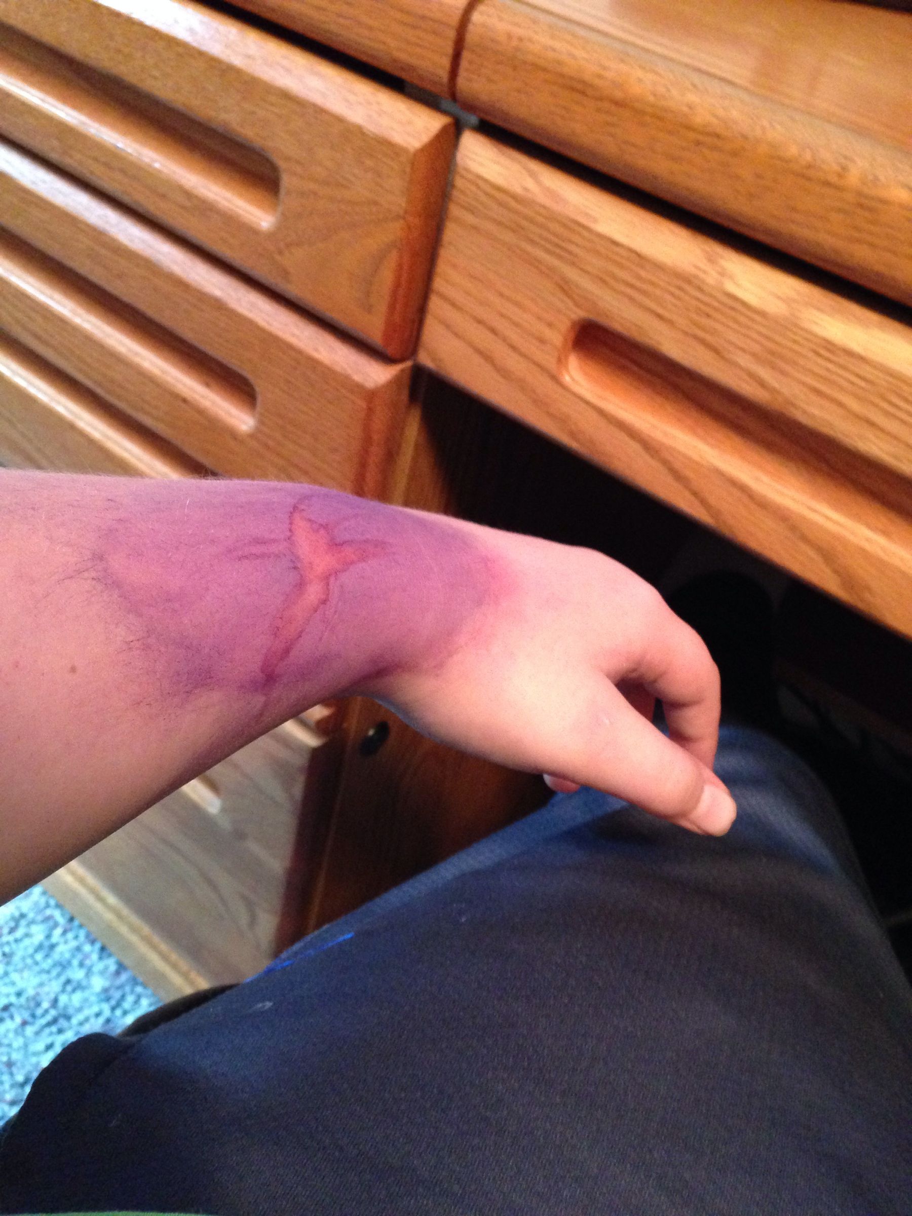 Water Color Bruise-Movie Effect