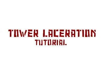Tower Laceration Tutorial