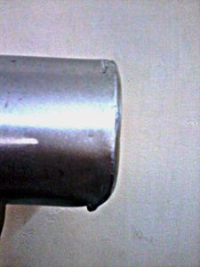 Dent Analysis