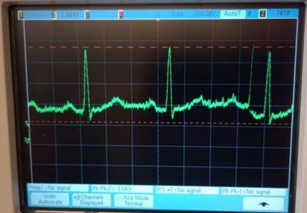 Arduino Display of Filtered ECG Signal