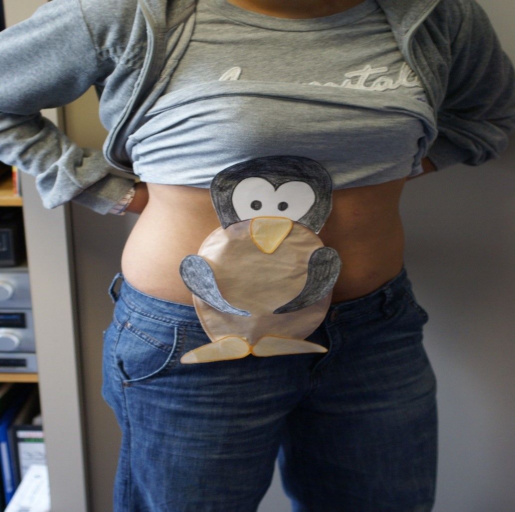 Changing an Ostomy Appliance 8 Steps Instructables