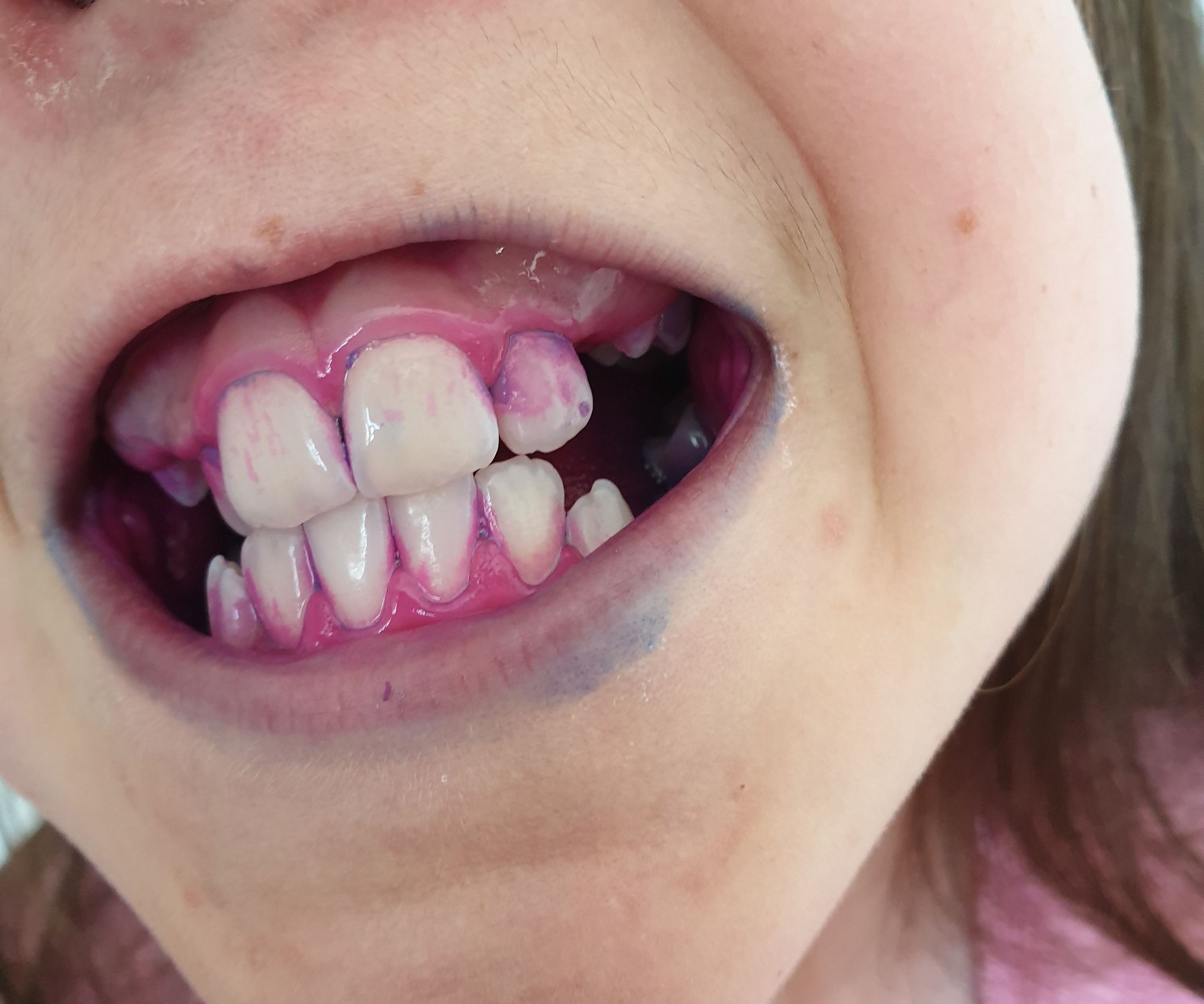 How to Get Your Children to Brush Their Teeth Properly