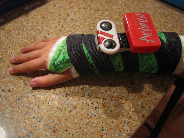 Broken Arm Lego Accessories