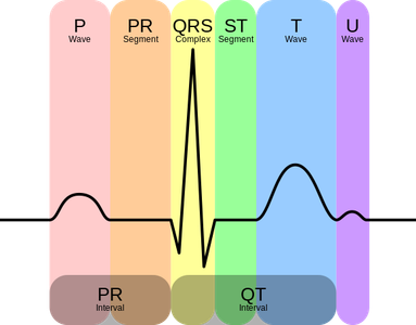 What Is ECG
