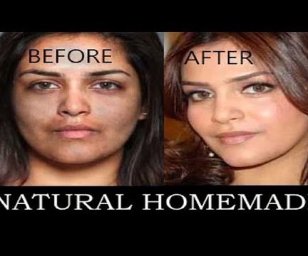 Amazing Skin Lightening Homemade Formula | Get Whiten Skin From Dark 