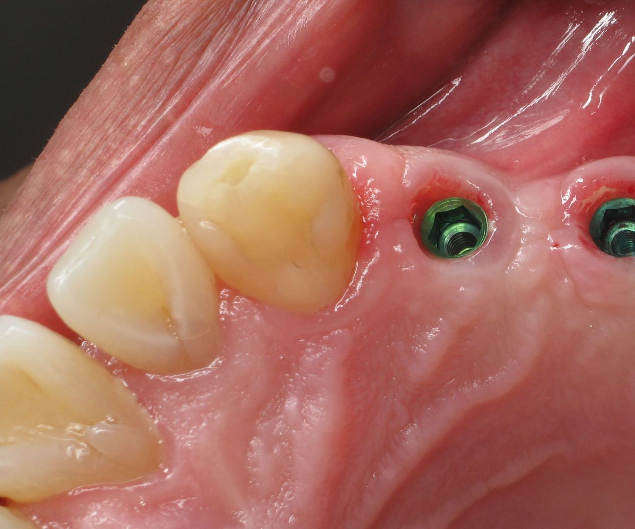 Dependable Methods to Understand to Learn About Disaster.